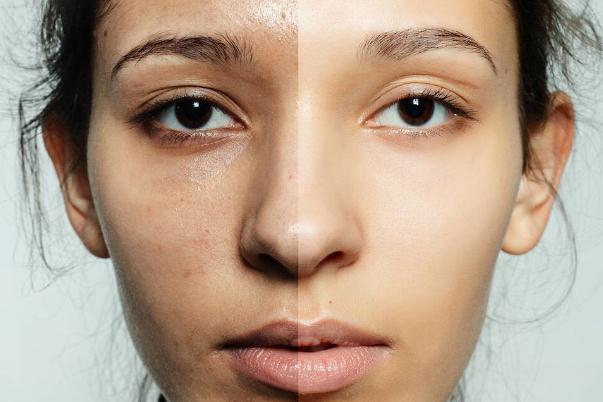 皮膚黃怎么變白 造成黃皮膚的原因有哪些 皮膚黃怎么變白 造成黃皮膚的原因有哪些