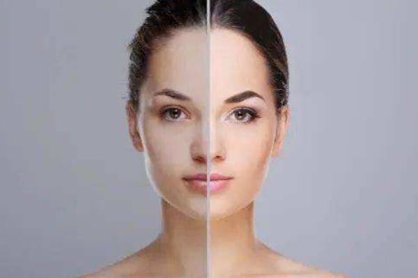 皮膚暗黃吃什么維生素比較好 皮膚暗黃粗糙毛孔大怎么改善 皮膚暗黃吃什么維生素比較好 皮膚暗黃粗糙毛孔大怎么改善