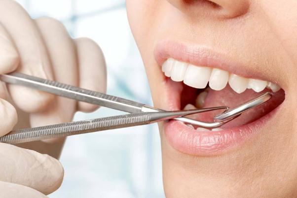 鑲牙要把牙根拔掉嗎 鑲牙有幾種方式哪個好 鑲牙要把牙根拔掉嗎 鑲牙有幾種方式哪個好