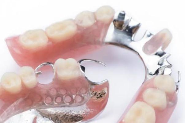 鑲牙要多長時(shí)間才能完成 鑲牙后的注意事項(xiàng) 鑲牙要多長時(shí)間才能完成 鑲牙后的注意事項(xiàng)