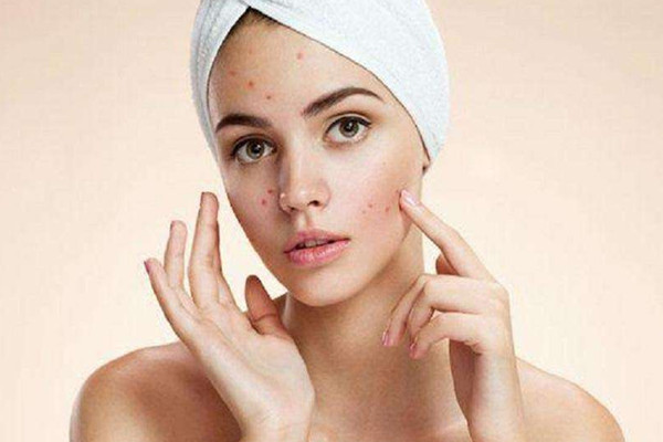 痘痘擠了之后能用酒精消毒嗎 痘痘擠了之后能用蘆薈膠嗎 痘痘擠了之后能用酒精消毒嗎 痘痘擠了之后能用蘆薈膠嗎