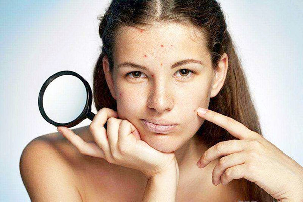 痘痘擠了一直流血怎么辦 痘痘擠了一半沒擠干凈怎么辦 痘痘擠了一直流血怎么辦 痘痘擠了一半沒擠干凈怎么辦