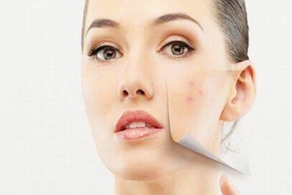 痘痘擠了一直流血怎么辦 痘痘擠了一半沒擠干凈怎么辦 痘痘擠了一直流血怎么辦 痘痘擠了一半沒擠干凈怎么辦