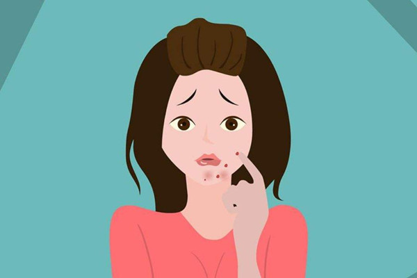 痘痘擠了變黑了是怎么回事 痘痘擠了后變成肉疙瘩怎么辦 痘痘擠了變黑了是怎么回事 痘痘擠了后變成肉疙瘩怎么辦