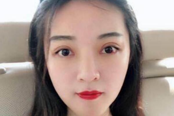 割雙眼皮是去醫(yī)院好還是整形醫(yī)院好 割雙眼皮是冬天好還是夏天好 割雙眼皮是去醫(yī)院好還是整形醫(yī)院好 割雙眼皮是冬天好還是夏天好