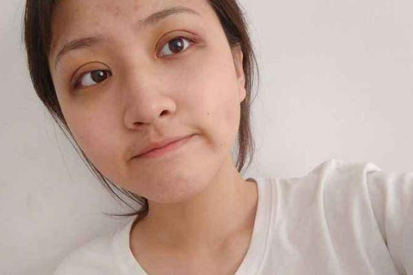 割雙眼皮要冰敷幾天 割雙眼皮要不要做翹睫 割雙眼皮要冰敷幾天 割雙眼皮要不要做翹睫