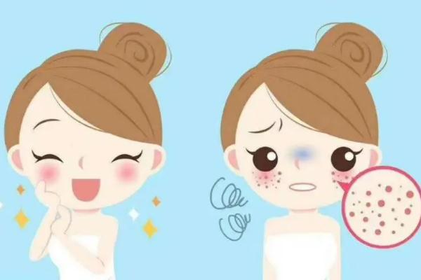 收縮毛孔的水光針叫什么 收縮毛孔是什么意思 收縮毛孔的水光針叫什么 收縮毛孔是什么意思