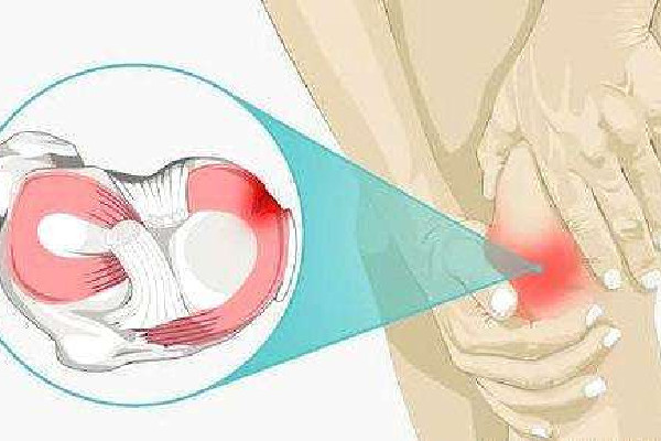 徐夢桃摘金背后:半月板切除70% 半月板損傷怎么造成的 徐夢桃摘金背后:半月板切除70% 半月板損傷怎么造成的