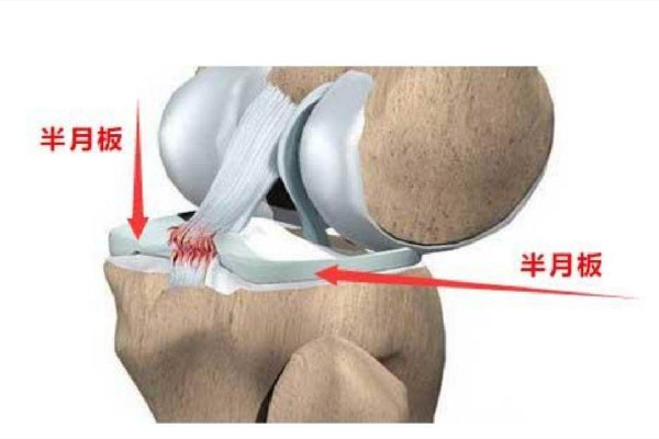 徐夢桃摘金背后:半月板切除70% 半月板損傷怎么造成的 徐夢桃摘金背后:半月板切除70% 半月板損傷怎么造成的