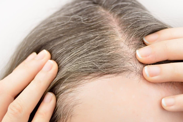 有白頭發(fā)染什么顏色好 有白頭發(fā)會(huì)遺傳嗎 有白頭發(fā)染什么顏色好 有白頭發(fā)會(huì)遺傳嗎