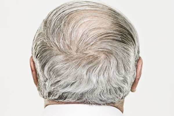 白頭發(fā)會(huì)不會(huì)越染越多 白頭發(fā)用淘米水洗有用嗎 白頭發(fā)會(huì)不會(huì)越染越多 白頭發(fā)用淘米水洗有用嗎