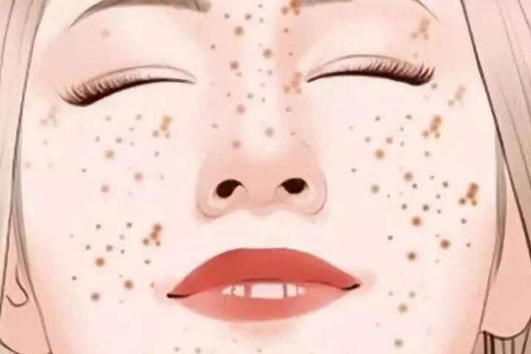 皮秒祛斑有的結痂有的不結痂為什么 皮秒祛斑有尷尬期嗎 皮秒祛斑有的結痂有的不結痂為什么 皮秒祛斑有尷尬期嗎