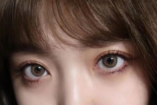 開眼角有必要嗎 開眼角會長回去嗎 開眼角有必要嗎 開眼角會長回去嗎