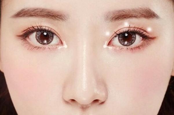 開(kāi)眼角的回縮期是多久 開(kāi)眼角是從哪個(gè)位置開(kāi) 開(kāi)眼角的回縮期是多久 開(kāi)眼角是從哪個(gè)位置開(kāi)