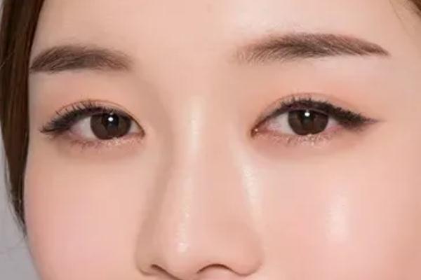 開(kāi)眼角的恢復(fù)期是多久 開(kāi)眼角要多久才能恢復(fù)正常 開(kāi)眼角的恢復(fù)期是多久 開(kāi)眼角要多久才能恢復(fù)正常