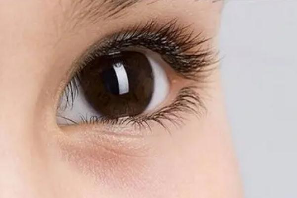 開眼角的副作用 開眼角的線沒拆干凈有影響嗎 開眼角的副作用 開眼角的線沒拆干凈有影響嗎