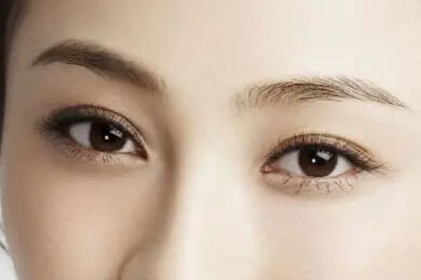 開(kāi)眼角的回縮期是多久 開(kāi)眼角是從哪個(gè)位置開(kāi) 開(kāi)眼角的回縮期是多久 開(kāi)眼角是從哪個(gè)位置開(kāi)