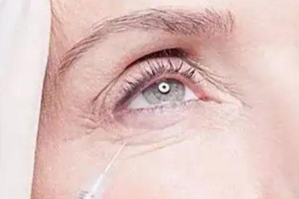 肉毒素除皺會(huì)引起眼皮腫嗎 肉毒素除皺對(duì)身體有害嗎 肉毒素除皺會(huì)引起眼皮腫嗎 肉毒素除皺對(duì)身體有害嗎