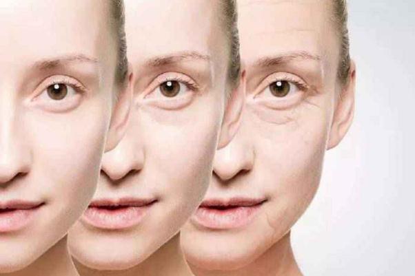 肉毒素除皺可以打眼袋部位嗎 肉毒素除皺可以打法令紋嗎 肉毒素除皺可以打眼袋部位嗎 肉毒素除皺可以打法令紋嗎