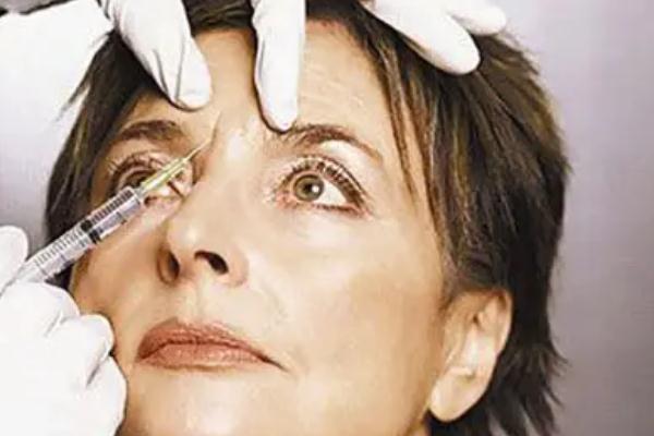 肉毒素除皺一針保持多長時間 肉毒素除皺的基本原理 肉毒素除皺一針保持多長時間 肉毒素除皺的基本原理
