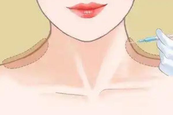 瘦肩針有什么好處 瘦肩針有后遺癥嗎 瘦肩針有什么好處 瘦肩針有后遺癥嗎