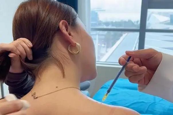 瘦肩針會不會手臂沒力氣 瘦肩針打完可以平躺嗎 瘦肩針會不會手臂沒力氣 瘦肩針打完可以平躺嗎