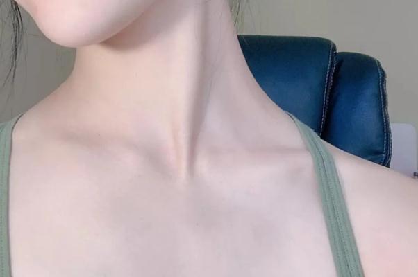 瘦肩針是打在哪塊肌肉上的 瘦肩針是打肉毒素還是溶脂針 瘦肩針是打在哪塊肌肉上的 瘦肩針是打肉毒素還是溶脂針