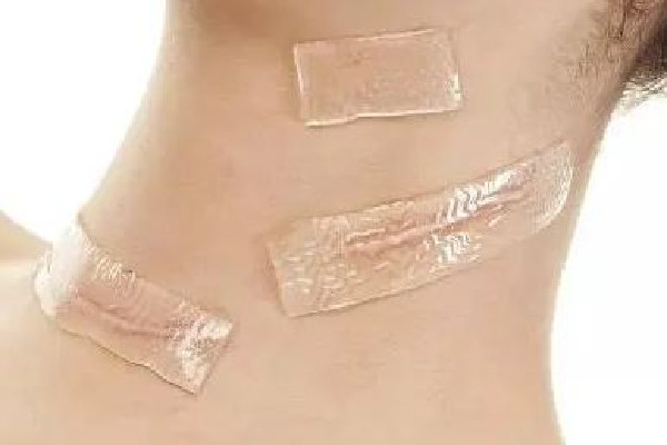 祛疤手術(shù)會(huì)疼嗎 祛疤手術(shù)做完多久可以洗澡 祛疤手術(shù)會(huì)疼嗎 祛疤手術(shù)做完多久可以洗澡