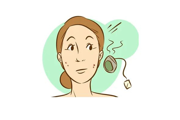 祛疤手術(shù)大概需要多久恢復(fù) 祛疤手術(shù)是不是越早做效果越好 祛疤手術(shù)大概需要多久恢復(fù) 祛疤手術(shù)是不是越早做效果越好