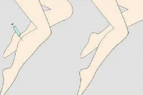 瘦腿針可以瘦幾厘米 瘦腿針可以自己打嗎 瘦腿針可以瘦幾厘米 瘦腿針可以自己打嗎