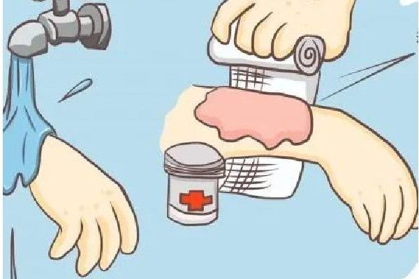 祛疤手術(shù)后要戒辛辣多長(zhǎng)時(shí)間 祛疤手術(shù)后不能吃什么 祛疤手術(shù)后要戒辛辣多長(zhǎng)時(shí)間 祛疤手術(shù)后不能吃什么