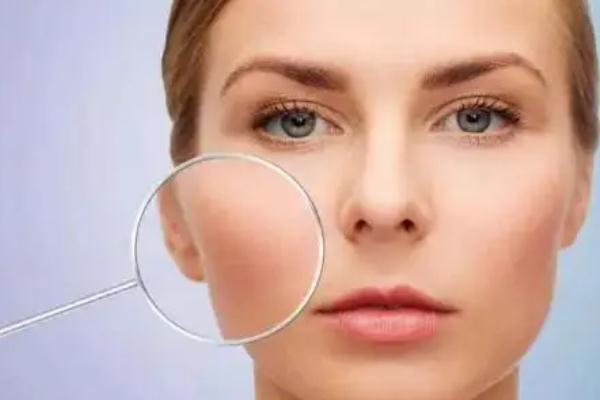 毛孔粗大有色斑怎么改善 毛孔粗大有什么危害 毛孔粗大有色斑怎么改善 毛孔粗大有什么危害