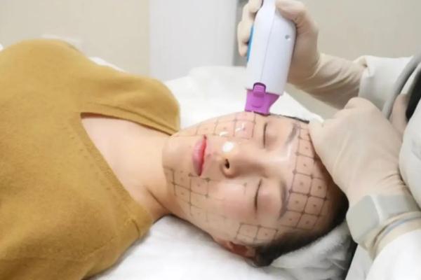 熱瑪吉是什么原理 熱瑪吉是什么美容項(xiàng)目 熱瑪吉是什么原理 熱瑪吉是什么美容項(xiàng)目