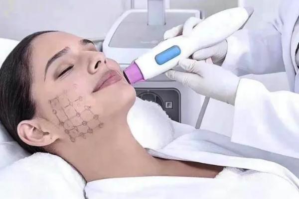 熱瑪吉的副作用和危害 熱瑪吉的優(yōu)點和缺點 熱瑪吉的副作用和危害 熱瑪吉的優(yōu)點和缺點