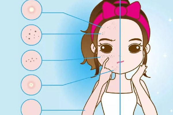 皮秒祛斑是不是要結(jié)痂了才管用 皮秒祛斑結(jié)痂掉了還是有斑 皮秒祛斑是不是要結(jié)痂了才管用 皮秒祛斑結(jié)痂掉了還是有斑