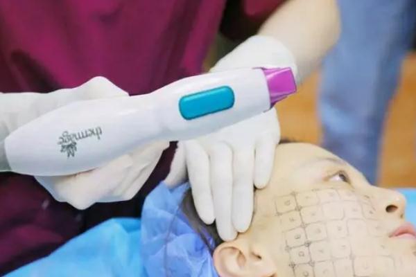 熱瑪吉會(huì)加速衰老嗎 熱瑪吉會(huì)燙傷皮膚嗎 熱瑪吉會(huì)加速衰老嗎 熱瑪吉會(huì)燙傷皮膚嗎