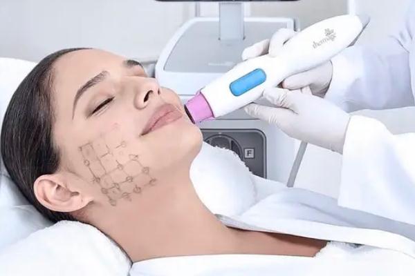 熱瑪吉有輻射嗎 熱瑪吉有恢復(fù)期嗎 熱瑪吉有輻射嗎 熱瑪吉有恢復(fù)期嗎