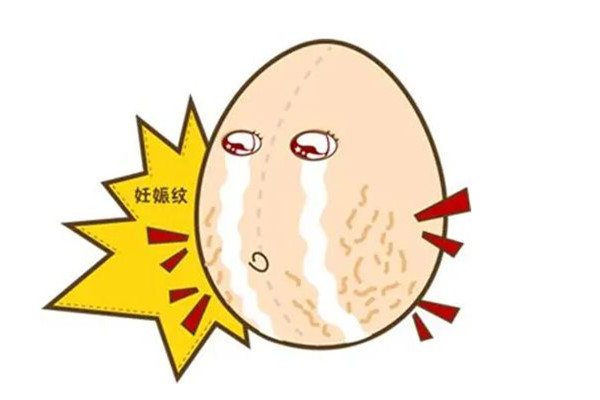 妊娠紋的坑怎么填平 妊娠紋的地方癢怎么回事 妊娠紋的坑怎么填平 妊娠紋的地方癢怎么回事