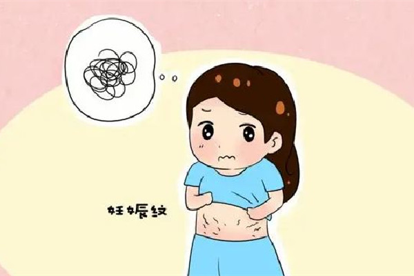 妊娠紋和肥胖紋是不是一樣的 妊娠紋和肥胖紋的區(qū)別 妊娠紋和肥胖紋是不是一樣的 妊娠紋和肥胖紋的區(qū)別