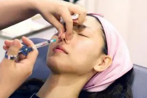 玻尿酸填充下巴有什么副作用 玻尿酸填充下巴能維持多長時(shí)間 玻尿酸填充下巴有什么副作用 玻尿酸填充下巴能維持多長時(shí)間