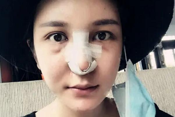 耳軟骨隆鼻的危害有哪些 耳軟骨隆鼻的缺點(diǎn) 耳軟骨隆鼻的危害有哪些 耳軟骨隆鼻的缺點(diǎn)