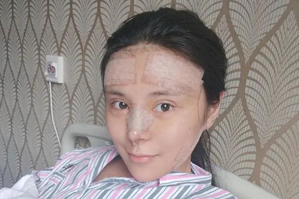 耳軟骨隆鼻是取一側還是兩側 耳軟骨隆鼻是用自己的耳軟骨嗎 耳軟骨隆鼻是取一側還是兩側 耳軟骨隆鼻是用自己的耳軟骨嗎