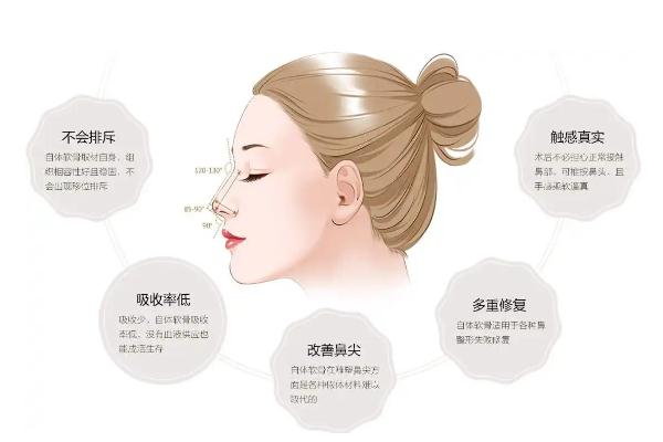 耳軟骨隆鼻耳朵會(huì)變形嗎 耳軟骨隆鼻耳朵疼幾天 耳軟骨隆鼻耳朵會(huì)變形嗎 耳軟骨隆鼻耳朵疼幾天