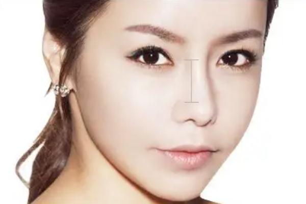 膨體隆鼻要多久才會(huì)恢復(fù)自然 膨體隆鼻要墊鼻尖嗎 膨體隆鼻要多久才會(huì)恢復(fù)自然 膨體隆鼻要墊鼻尖嗎