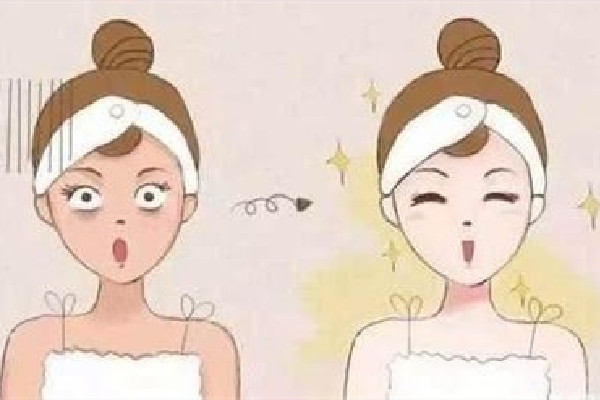 光子嫩膚是怎么操作的 光子嫩膚是全臉還是局部 光子嫩膚是怎么操作的 光子嫩膚是全臉還是局部