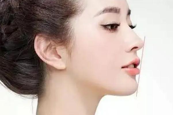 豐下巴哪種方法最好 豐下巴需要多少錢 豐下巴哪種方法最好 豐下巴需要多少錢