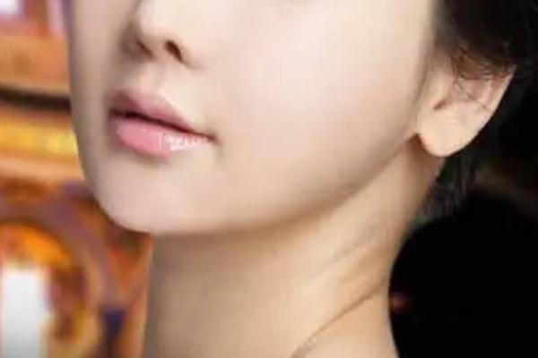 豐下巴會(huì)不會(huì)產(chǎn)生木偶紋 豐下巴會(huì)不會(huì)臉部下垂 豐下巴會(huì)不會(huì)產(chǎn)生木偶紋 豐下巴會(huì)不會(huì)臉部下垂