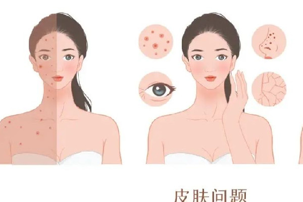 光子嫩膚是怎么操作的 光子嫩膚是全臉還是局部 光子嫩膚是怎么操作的 光子嫩膚是全臉還是局部