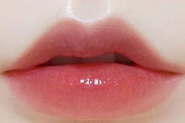 豐唇大概要多少錢 豐唇有哪些方法 豐唇大概要多少錢 豐唇有哪些方法