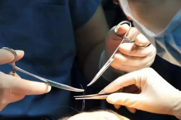 拉皮手術(shù)會(huì)把鼻子拉寬嗎 拉皮手術(shù)會(huì)腫幾天 拉皮手術(shù)會(huì)把鼻子拉寬嗎 拉皮手術(shù)會(huì)腫幾天